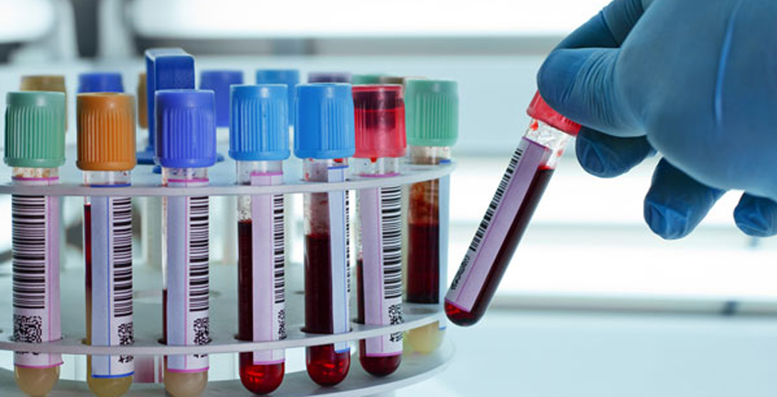 Conseils santé du Laboratoire COUDON Casablanca